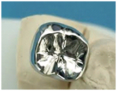 Metallic Crowns/Bridges