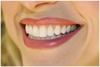 Smile Designing